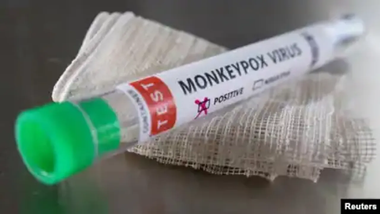 Monkeypox