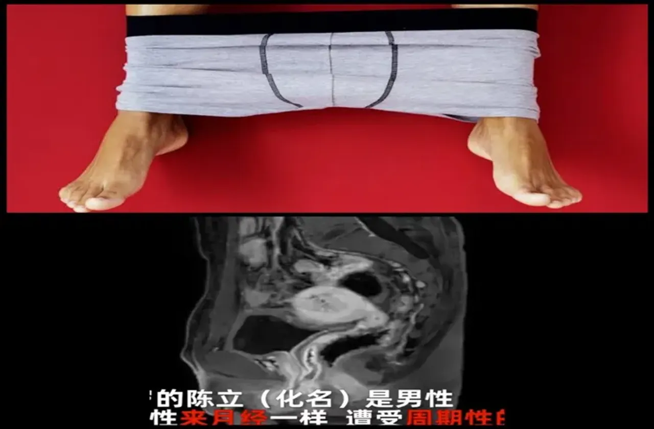 Male Menstruation