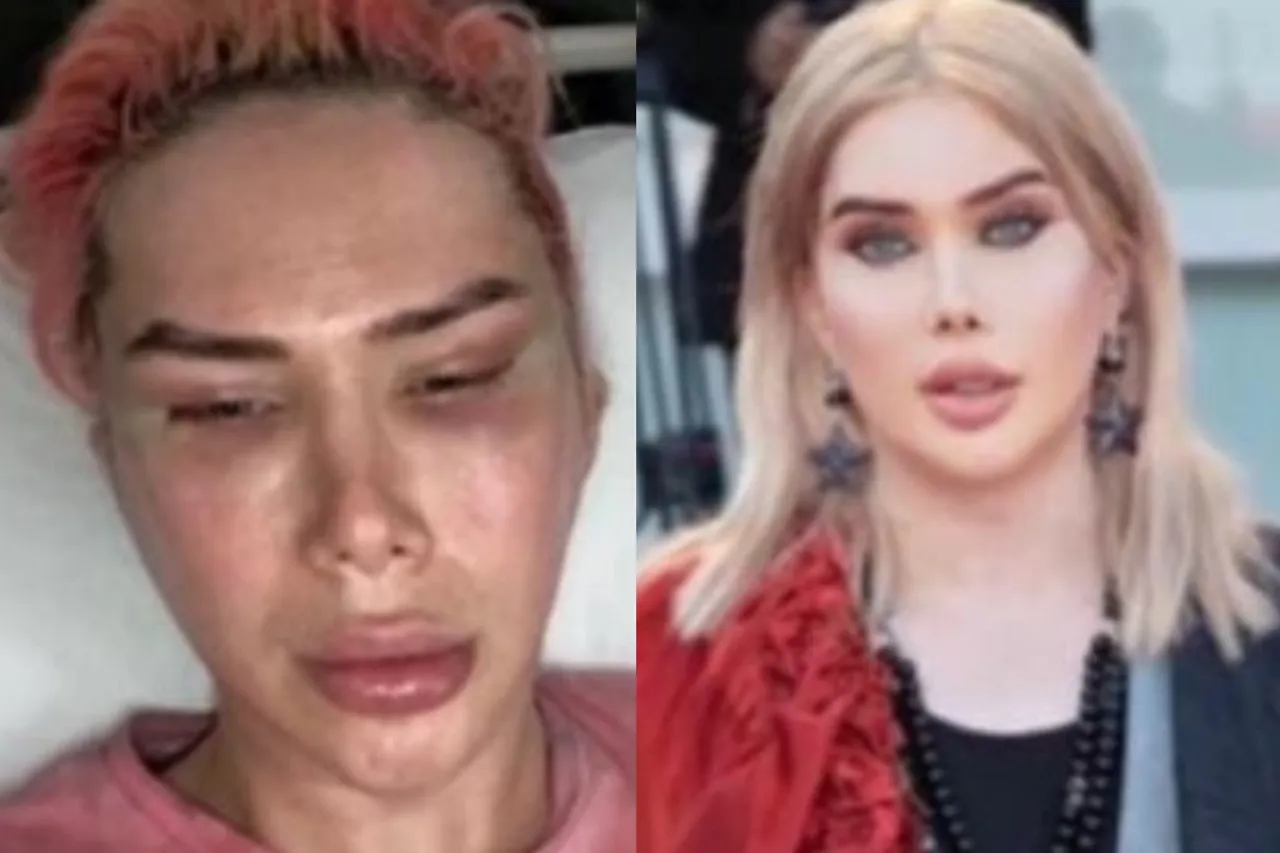 Cosmetic surgery