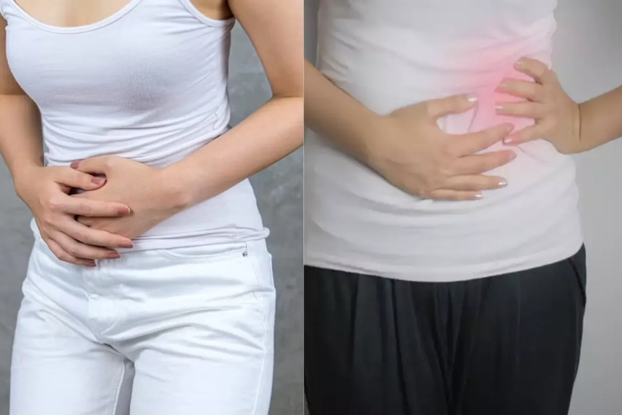 PCOS