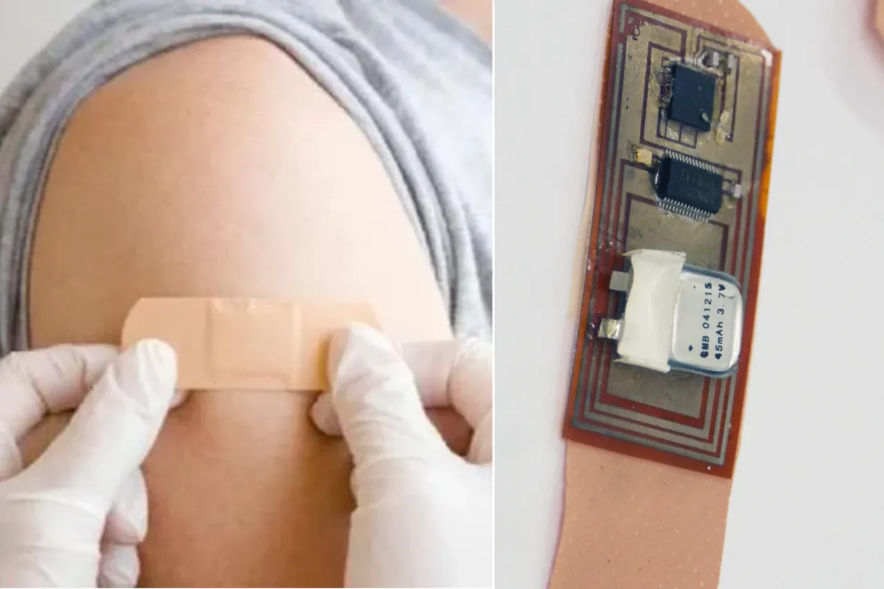 Wireless smart bandage