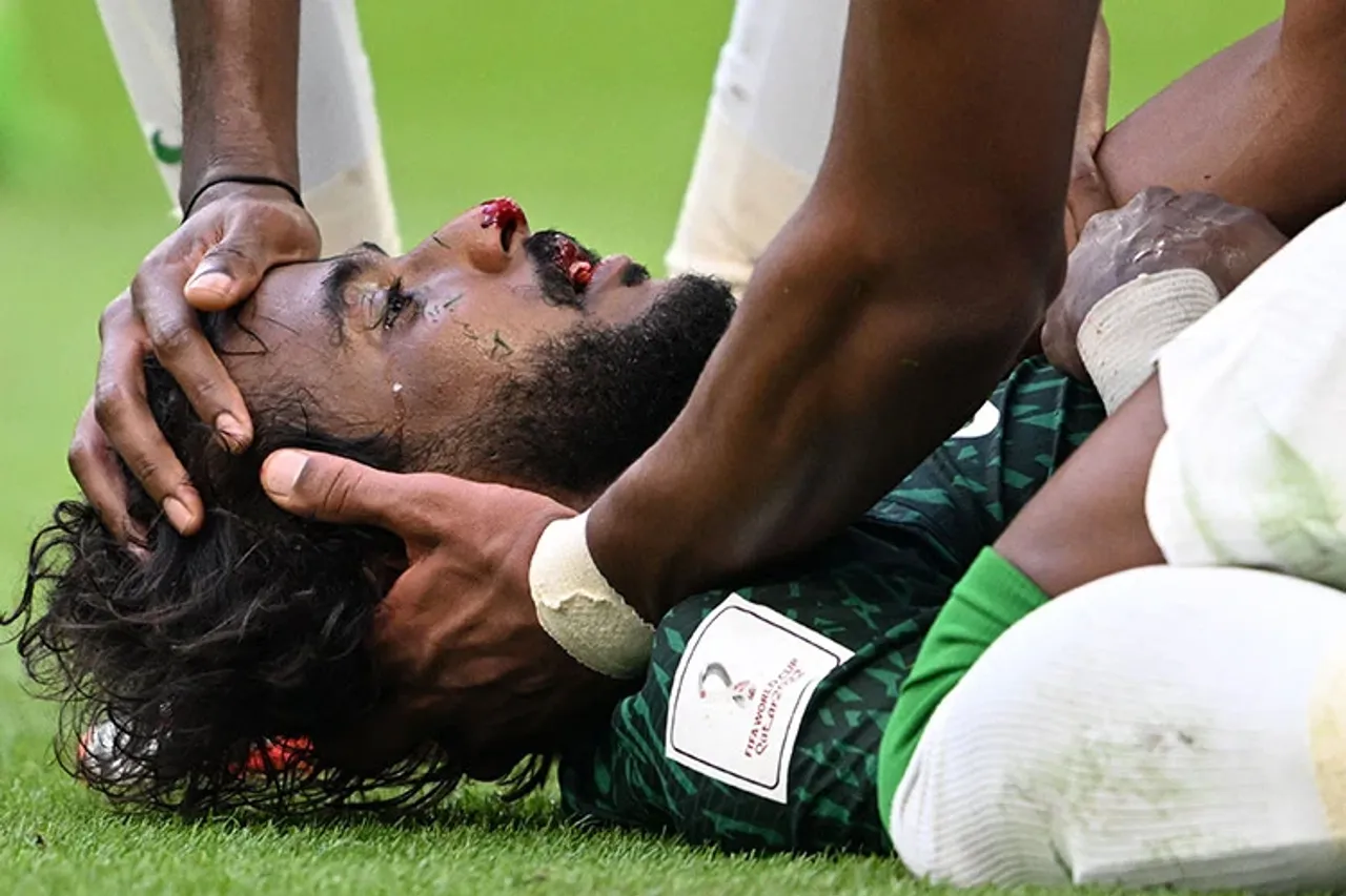 FIFA World Cup 2022: Saudi Arabia star Yasir Al Shahrani suffers broken jaw, internal bleeding. Watch