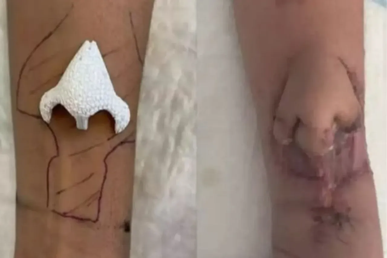 France woman nose