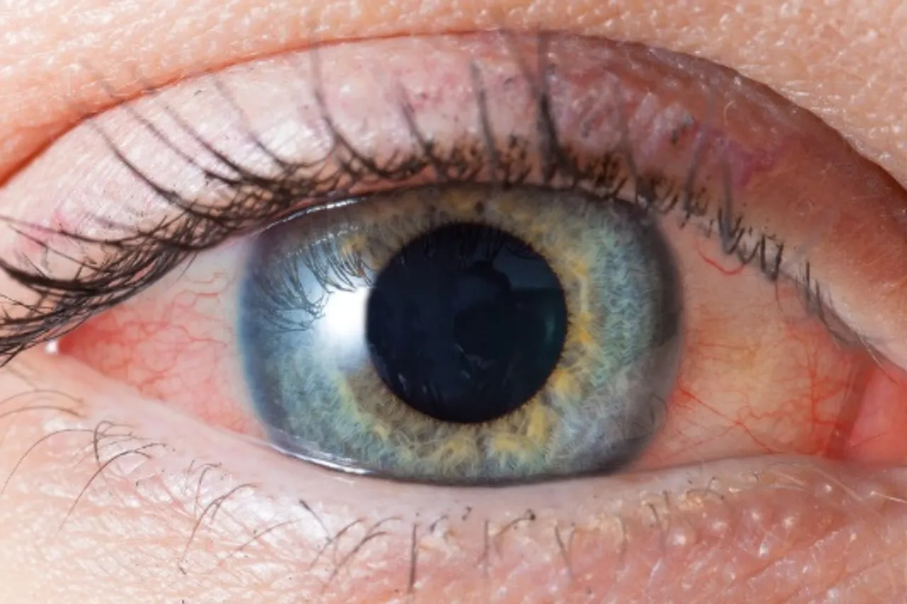 Pollution Eye Care Tips