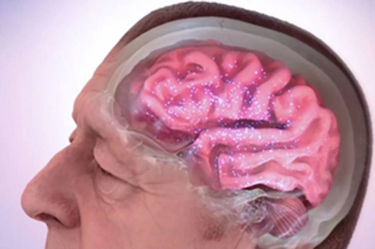 Alzheimer's disease
