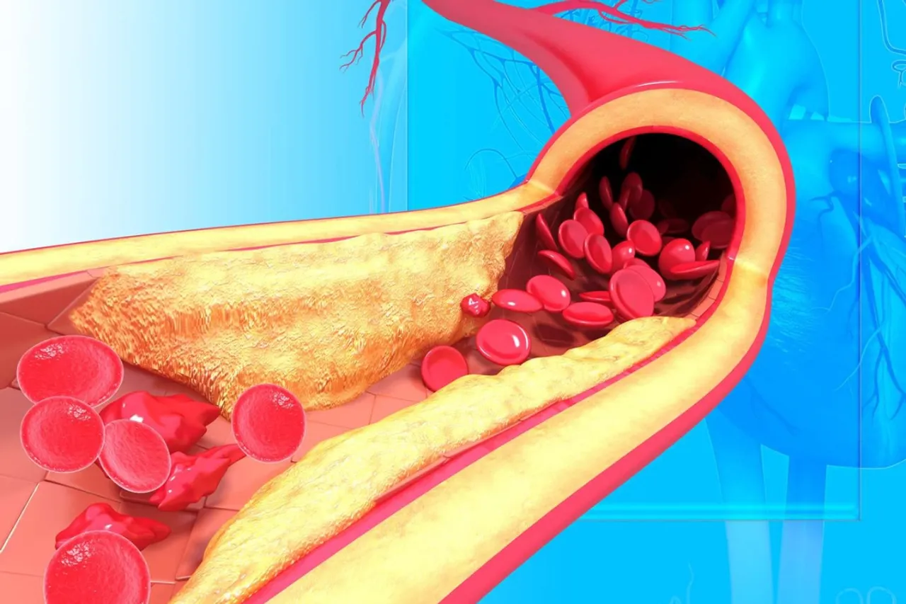 Cholesterol level