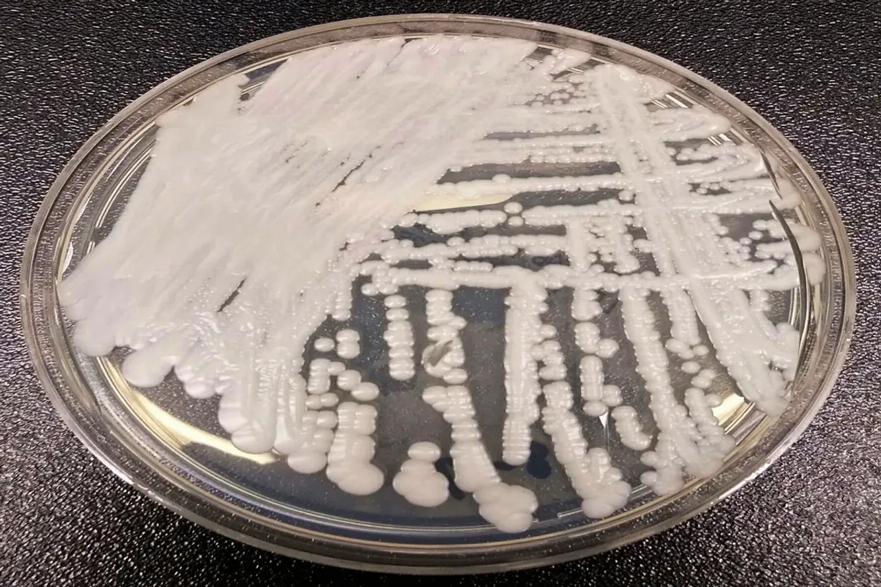 CDC