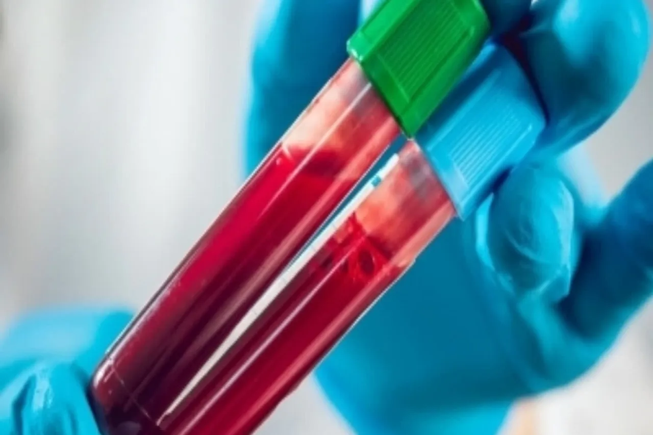 Cancer detection