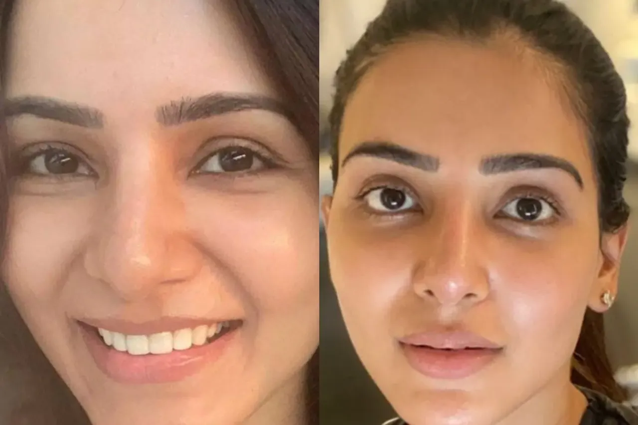 Skincare Tips