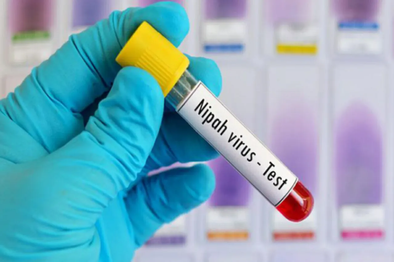 Nipah Virus