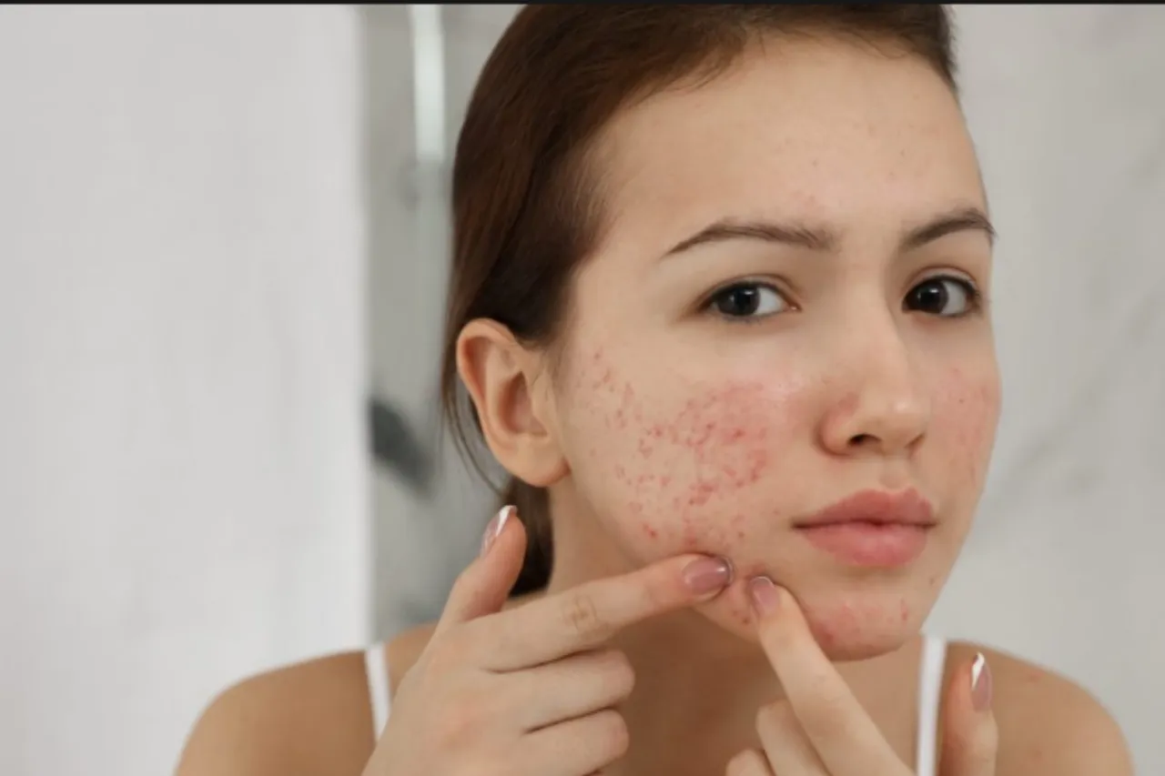 Skincare Tips