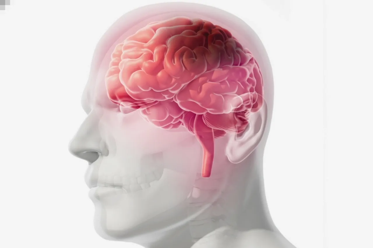 Mini Stroke Vs Major Stroke