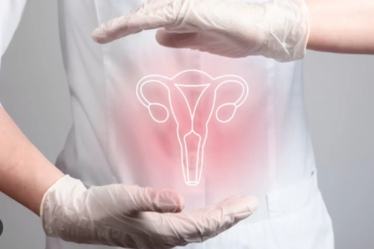 Cervical Cancer