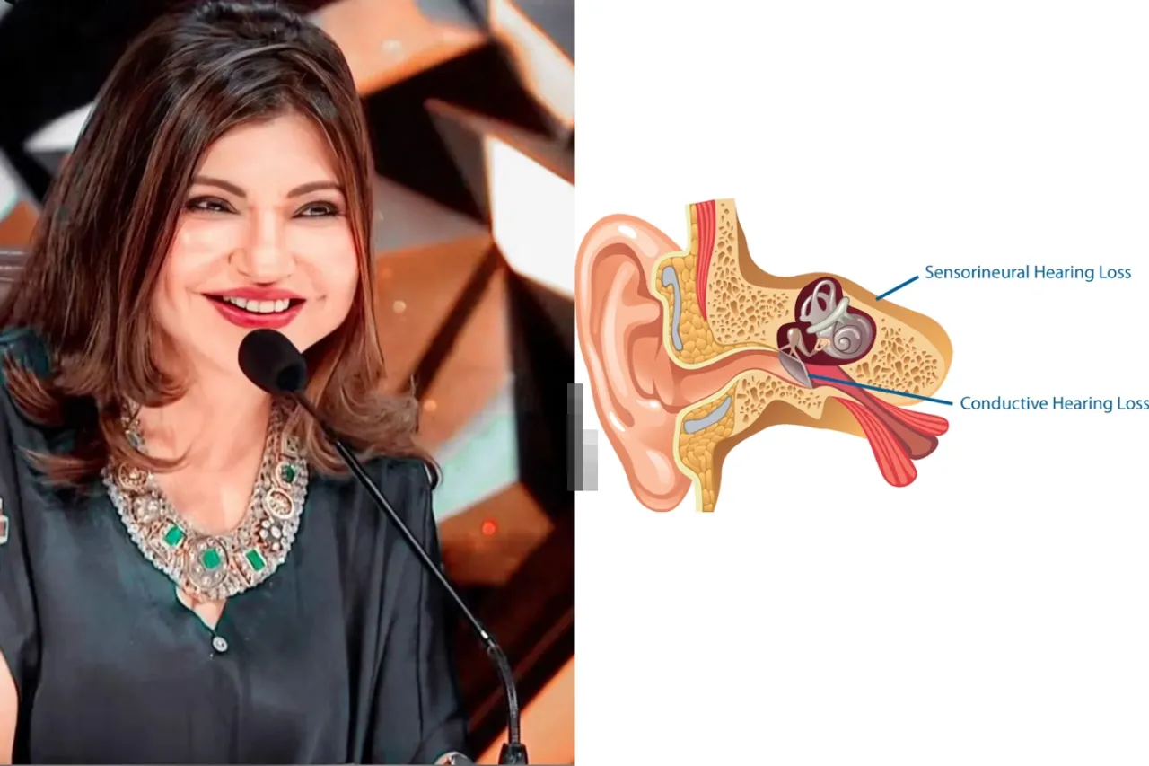 Sensorineural Hearing Loss