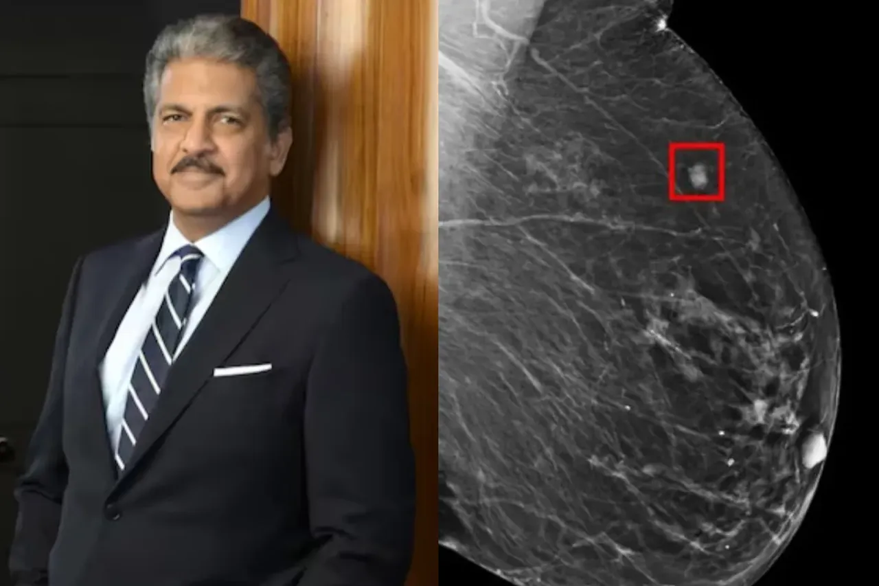 Anand Mahindra
