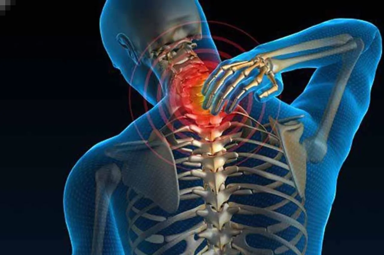 Cervical Spondylitis