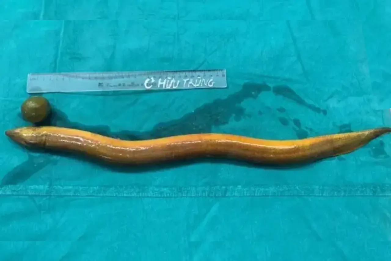 Live Eel