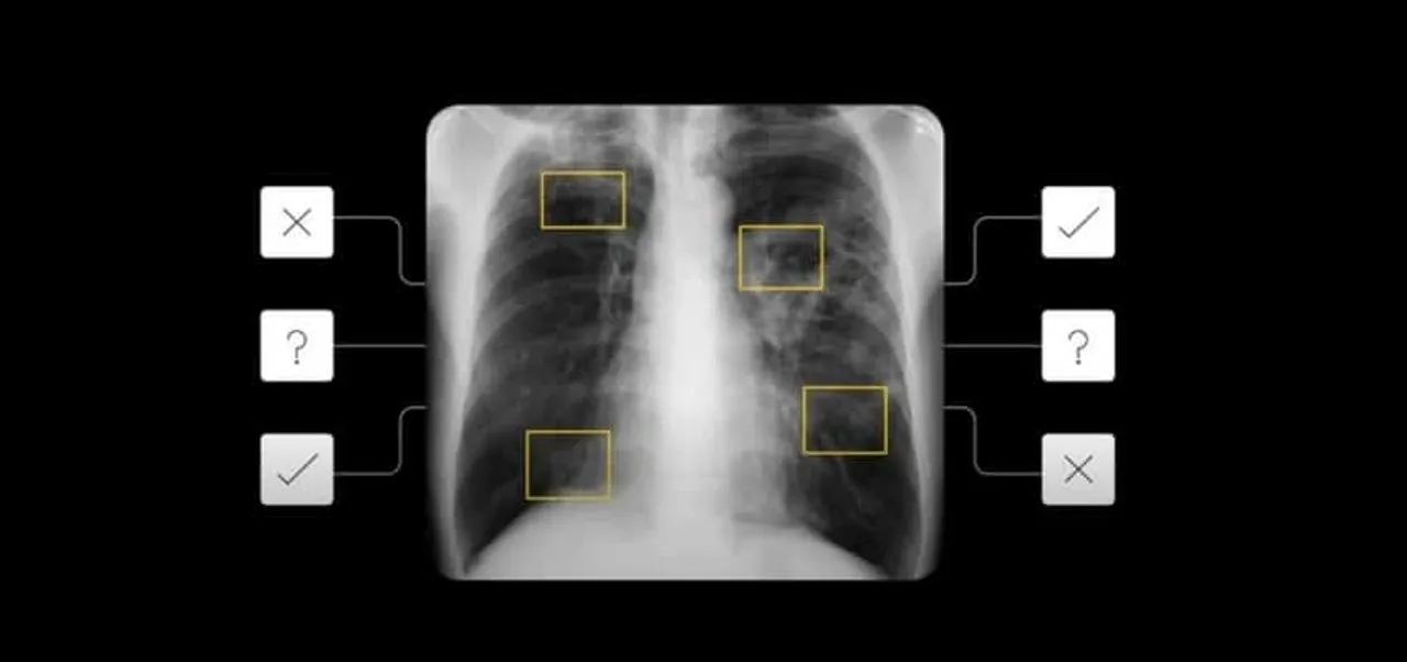Google-AI-TB