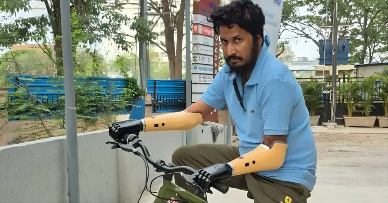 affordable prosthetics india
