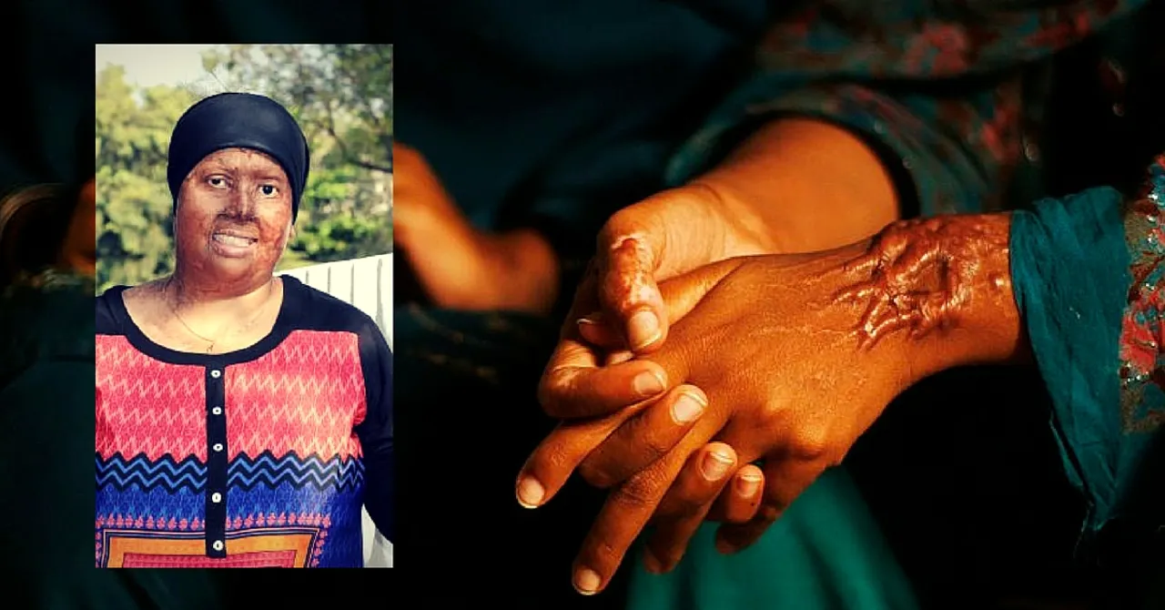 This Acid Attack Survivor Wants You to Donate Your Skin. Here's Why