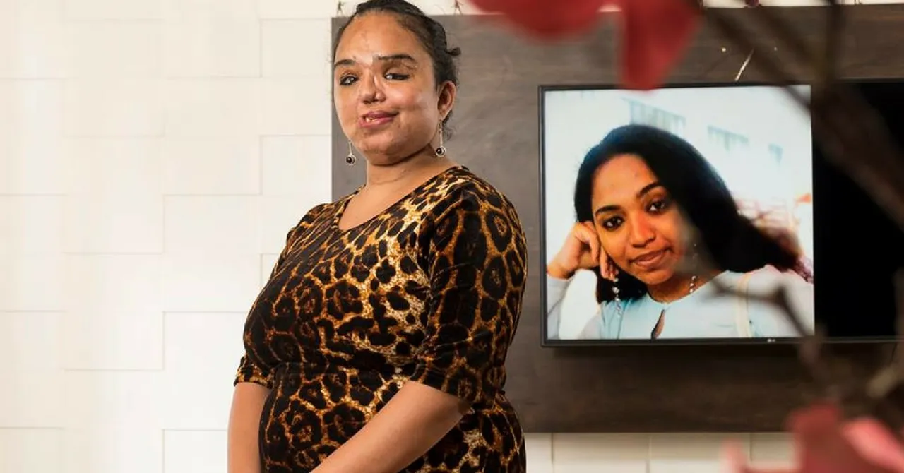 27 Surgeries Later, This Woman Has Taught The Internet a Thing or Two About Gratitude