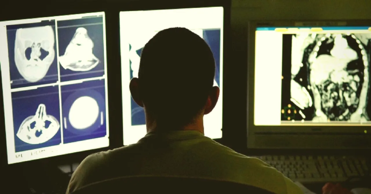 MRI/CT Scans Goes 3D, Thanks to IIIT-D Students' New Virtual Reality App