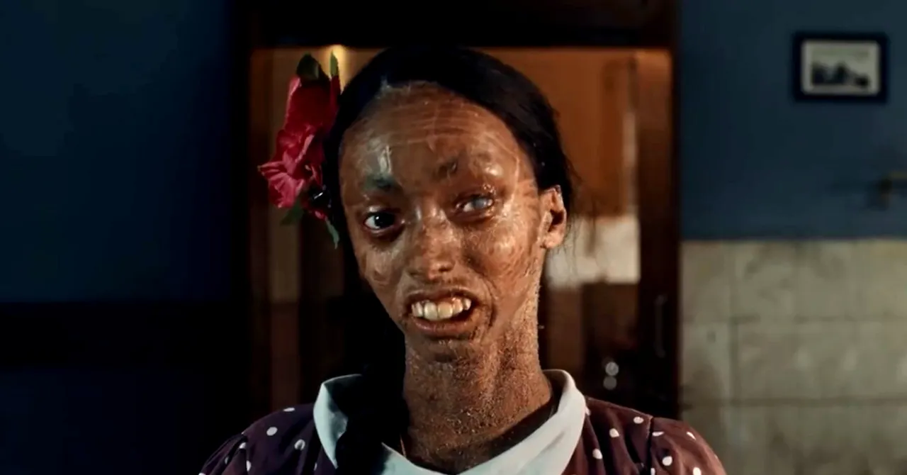 Abandoned Due to Rare Genetic Disorder, Nisha's Life Was Transformed By a Mother's Unconditional Love