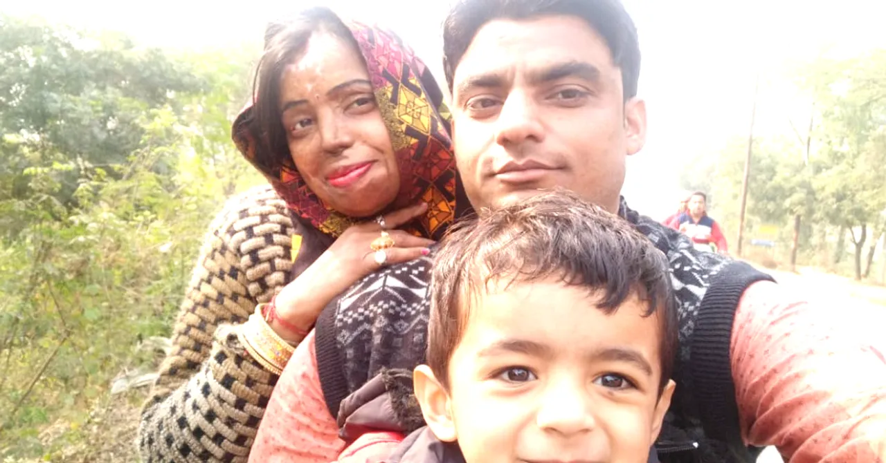 Brave Acid Attack Survivor Now Helps Victims of Rape, Assault & Domestic Violence