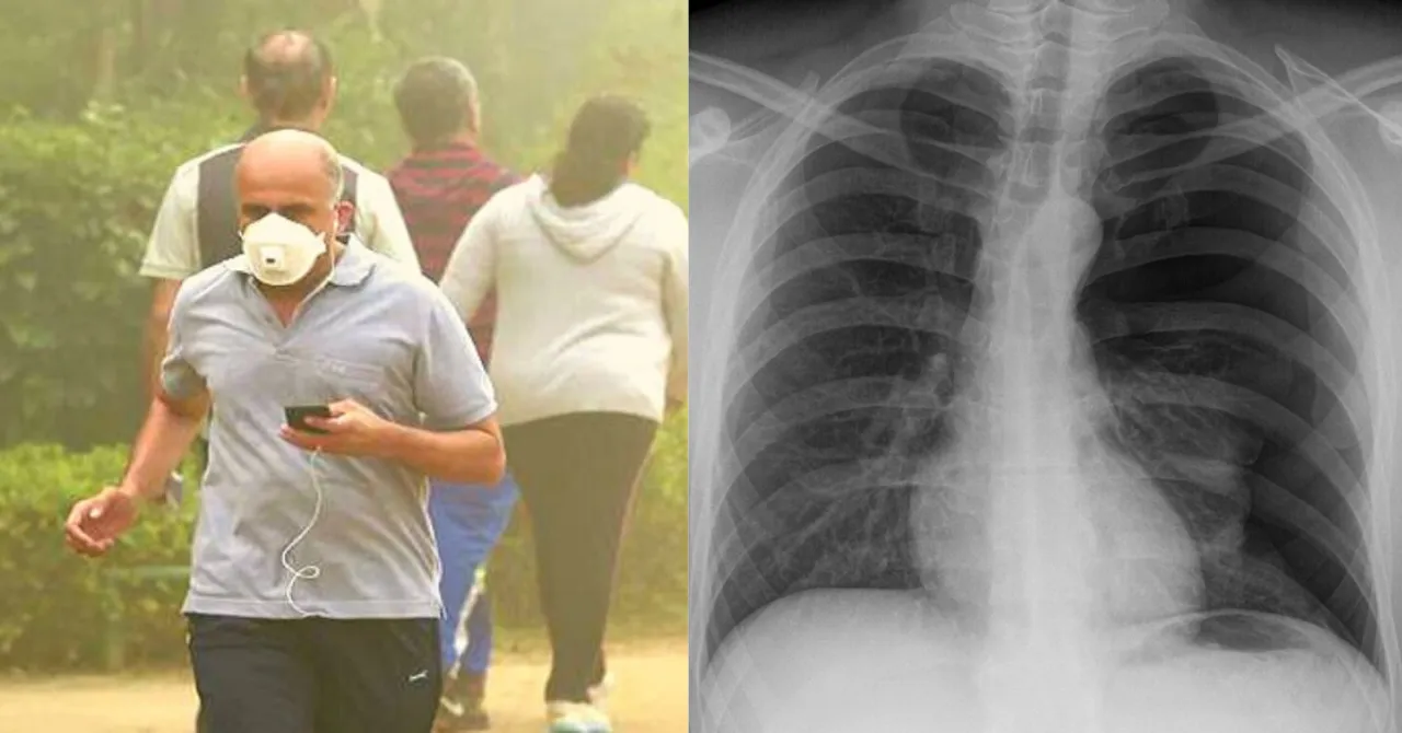 COPD: All you need to know About The Lung Disease That's Killed Millions in India