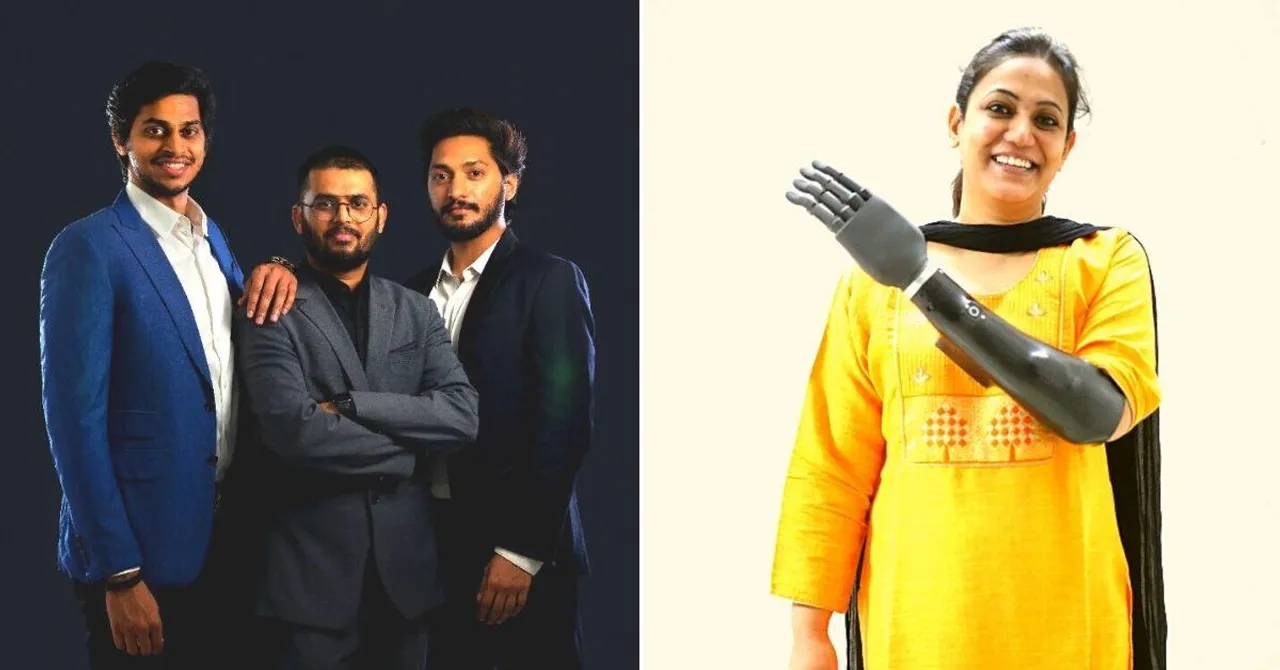 Inspired by Dr Kalam, Hyd Innovator Builds Lightweight Bionic Hand At 1/10 The Cost