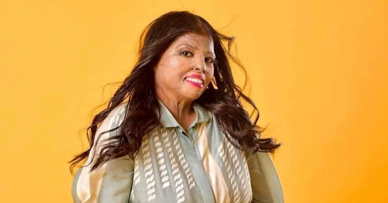 'Art Helped Me Heal': Beauty Content Creator Mannu's Inspiring Journey to Confidence After Surviving a Burn