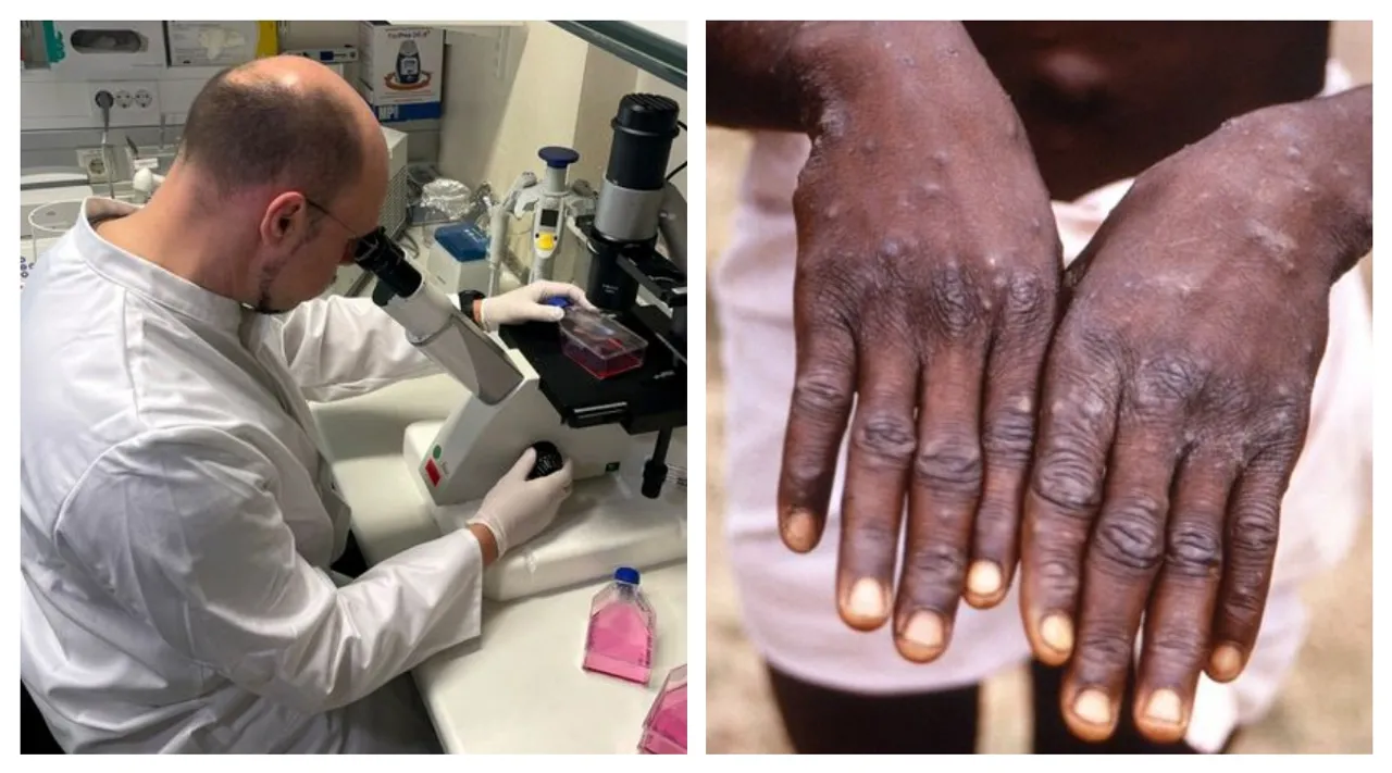 Monkeypox cases detected in over 12 countries