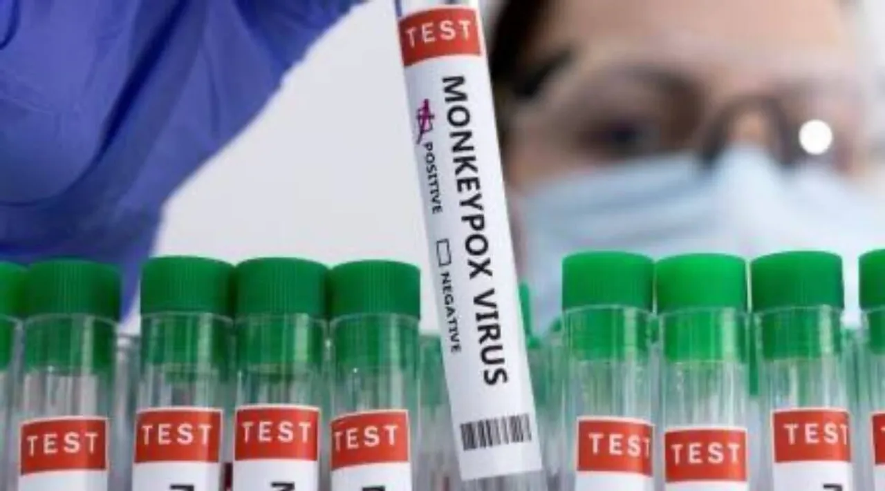Monkeypox Virus RT PCR-based kit