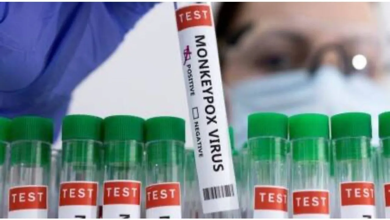 after reports of india first confirmed monkeypox case kerala issue alert in five districts