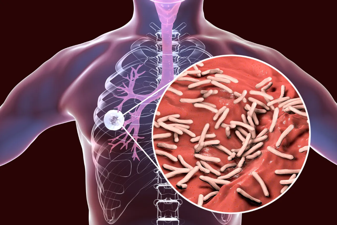 WHO Report: Top 10 countries with most tuberculosis cases