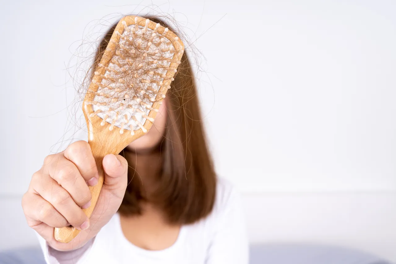 10 Natural Remedies To Stop Hair Loss 