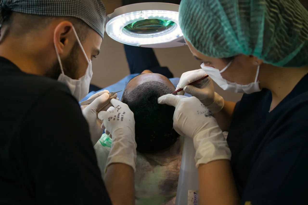 Two dead after hair transplant: Key risks & precautions you need to know