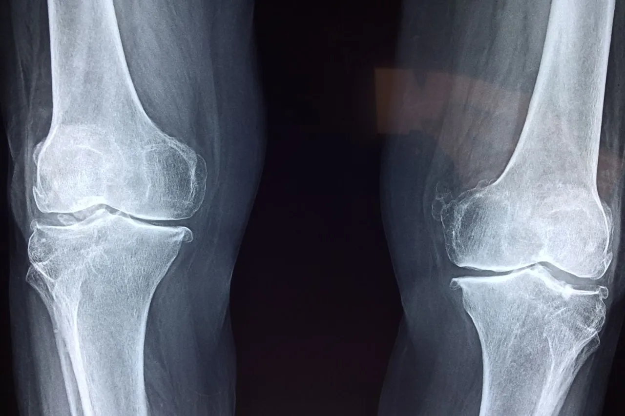 Bone Health 