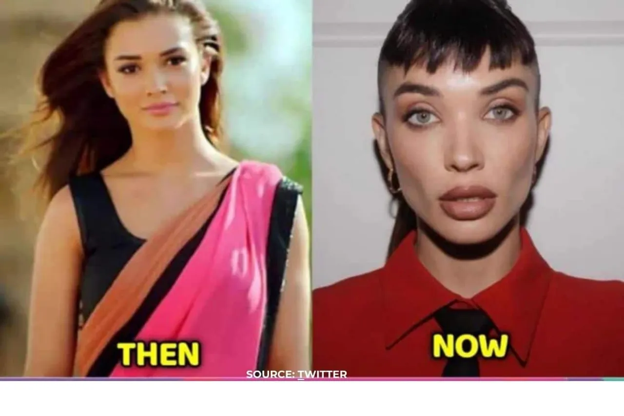 How did Amy Jackson's face changed so much?