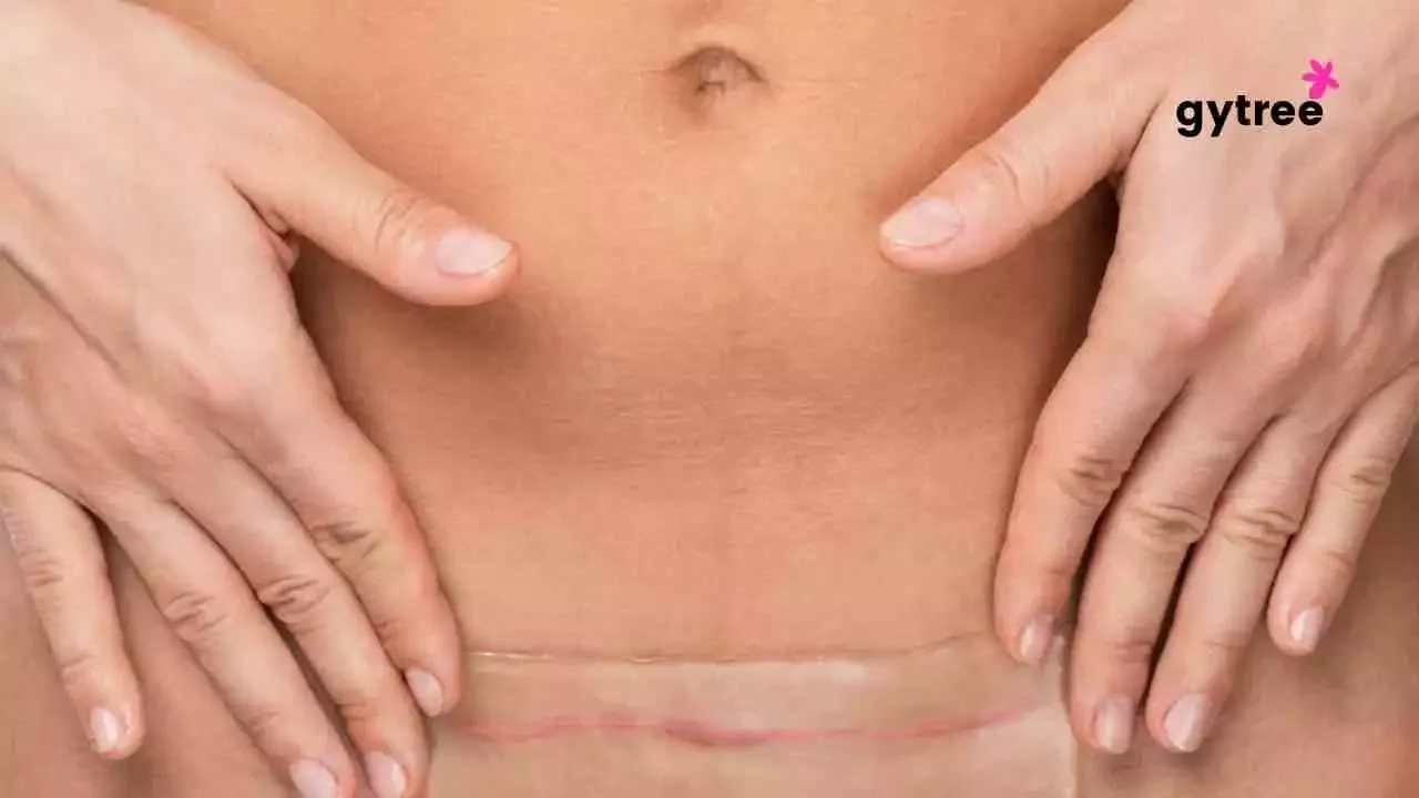 A Guide to Postpartum Weight Loss