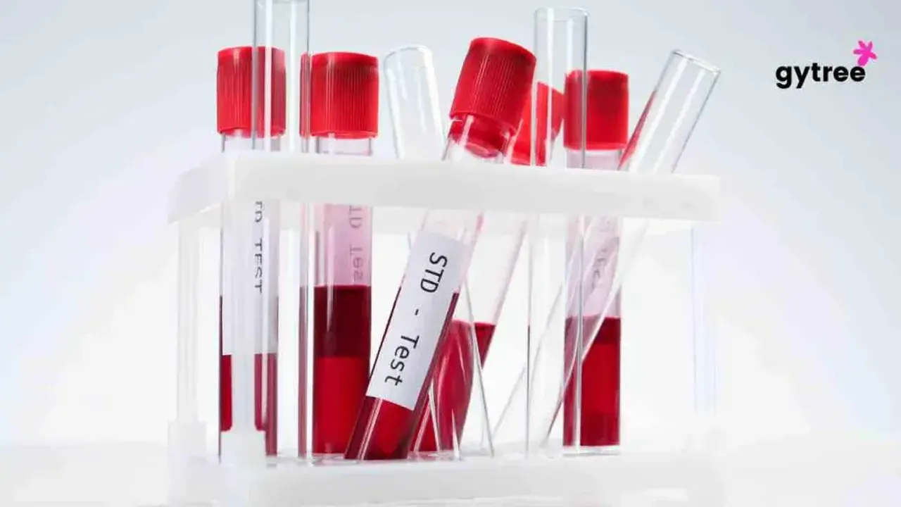 STD Testing Window: Meaning and Importance 