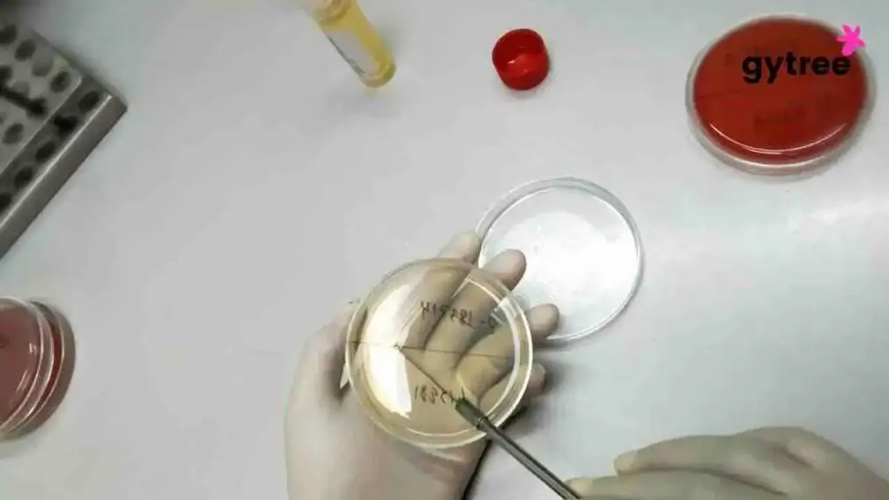 7 Symptoms of UTI and Management Tips: UTIs Can Be Mistaken For Other Health Issues
