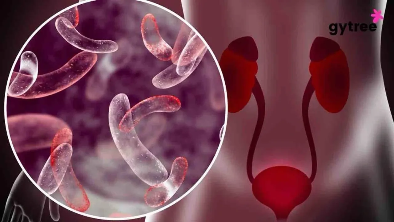 Navigating Chronic Bladder Infections: Causes, Symptoms, and Effective Strategies