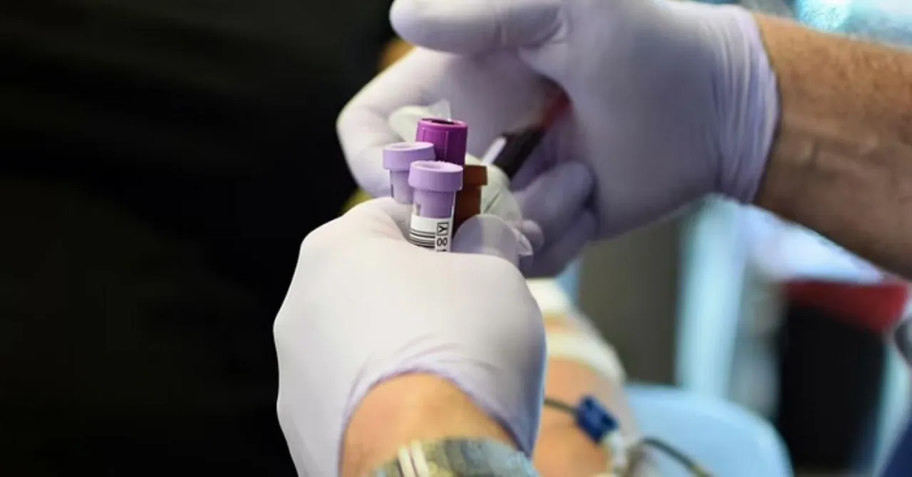 Covid-19 Test Procedure