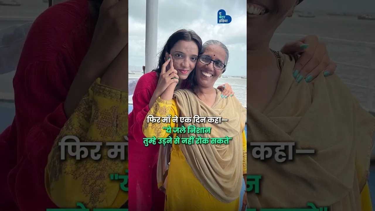 ज़ख़्मों को छुपाकर नहीं उन पर गर्व करके जीते ज़िंदगी | Mitali Sonawane | Inspirational Story