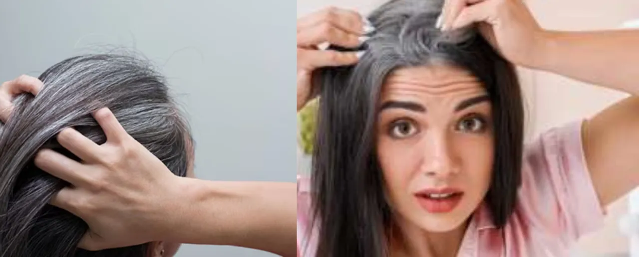 White Hair Black
