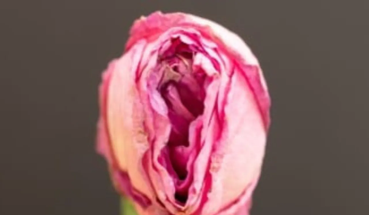 vaginal dryness0000. png