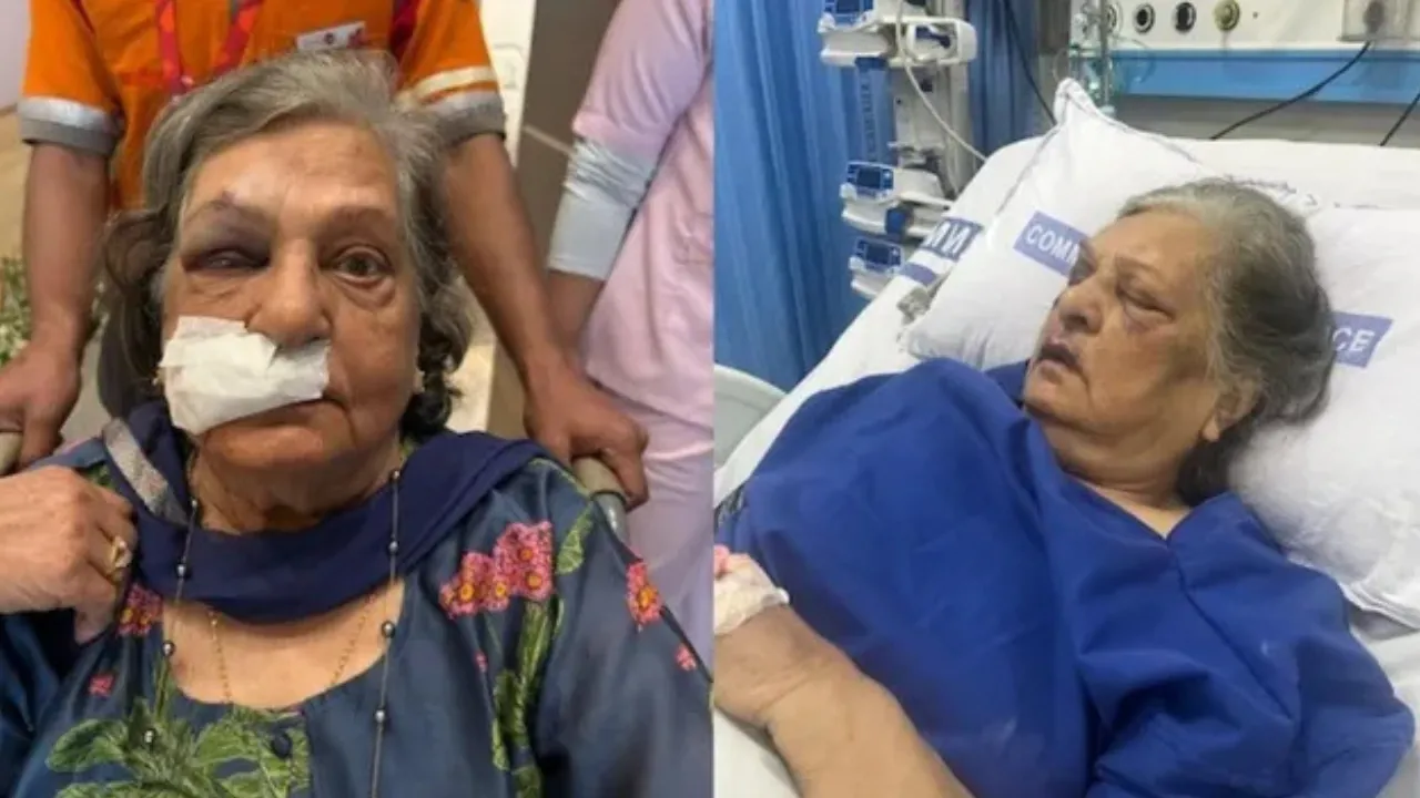 Elderly Woman Injured At Delhi Airport
