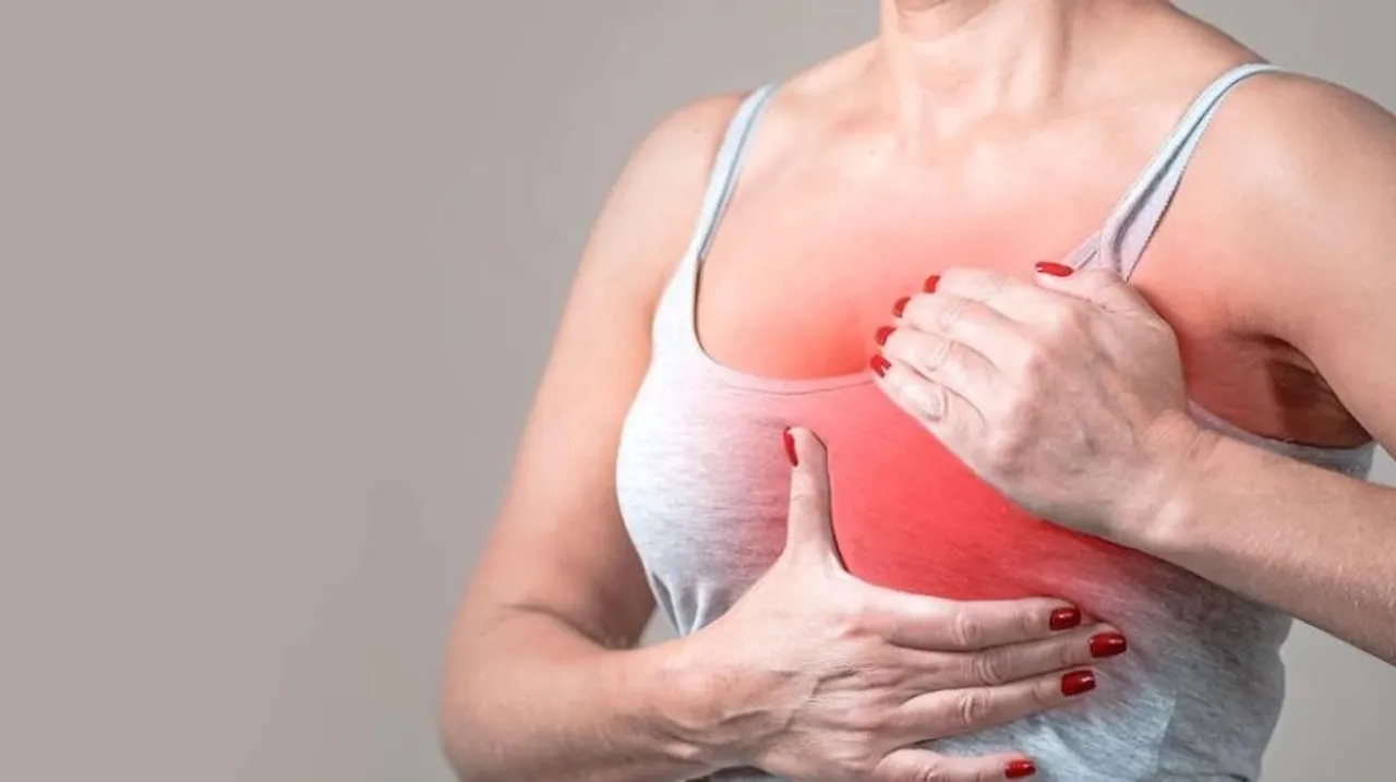 breast cancer