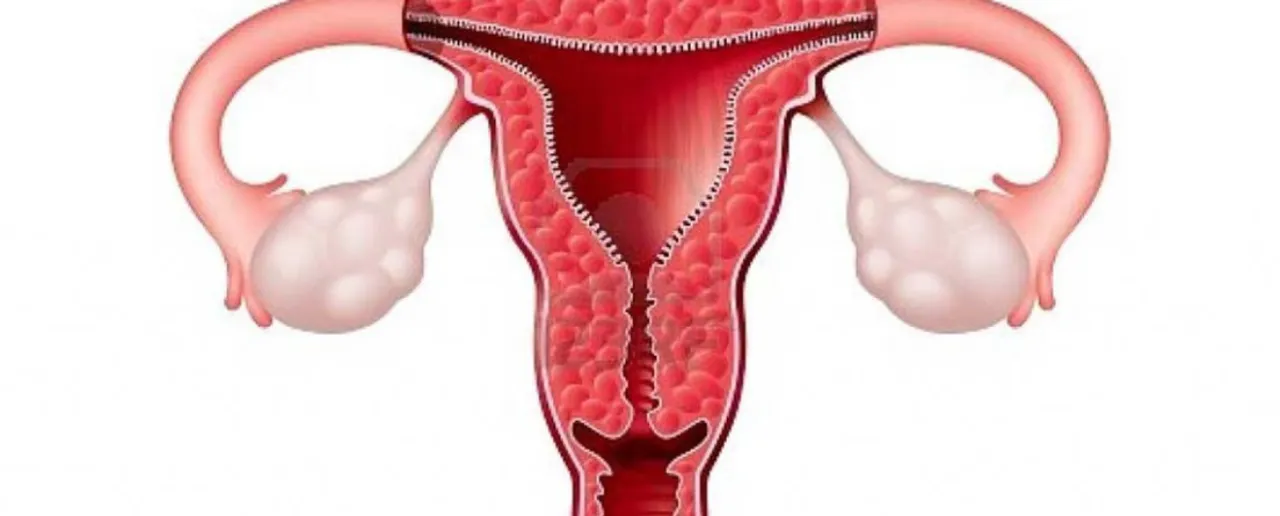 Vaginitis 0.png